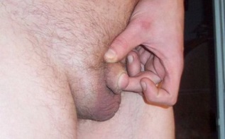 indicacións para a ampliación do pene